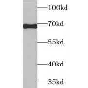 WB analysis of Jurkat cells, using AIF antibody (1/1000 dilution).