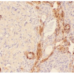 Androgen Induced 1 (AIG1) Antibody