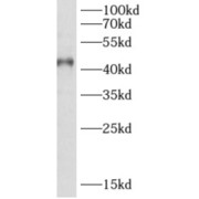 WB analysis of Y79 cells, using AIPL1 antibody (1/600 dilution).