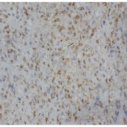 Autoimmune Regulator (AIRE) Antibody