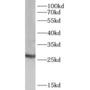 WB analysis of human placenta tissue, using AK3 antibody (1/500 dilution).