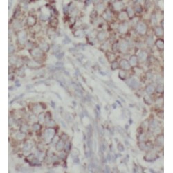 Adenylate Kinase 4, Mitochondrial (AK3L1) Antibody