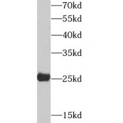 WB analysis of MCF7 cells, using AK3L1 antibody (1/1000 dilution).