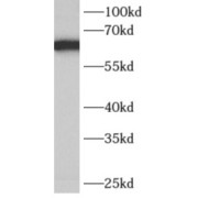 WB analysis of human brain tissue, using AK5 antibody (1/300 dilution).