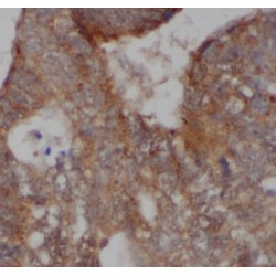 A Kinase Anchor Protein 1 (AKAP1) Antibody