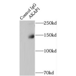 A Kinase Anchor Protein 1 (AKAP1) Antibody