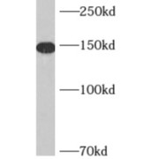 WB analysis of HeLa cells, using AKAP1 antibody (1/1000 dilution).