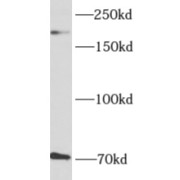 WB analysis of rat brain tissue, using AKAP12 antibody (1/600 dilution).