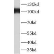 WB analysis of mouse testis tissue, using AKAP3 antibody (1/5000 dilution).