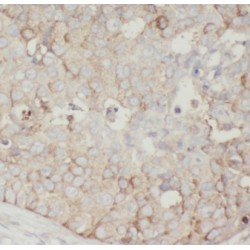 A-Kinase Anchor Protein 4 (AKAP4) Antibody