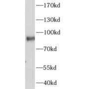 WB analysis of human testis tissue, using AKAP4 antibody (1/1500 dilution).