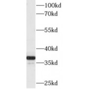 WB analysis of MCF7 cells, using AKR1C4 antibody (1/500 dilution).