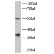 WB analysis of human liver tissue, using Fab00267 (AKR7A3 antibody (1/400 dilution).