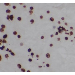 RAC-Gamma Serine/threonine-Protein Kinase (AKT3) Antibody