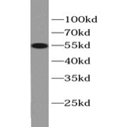 WB analysis of mouse liver tissue, using ALDH1A1 antibody (1/1000 dilution).