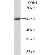 WB analysis of MCF7 cells, using ALDH1A1 antibody (1/500 dilution).