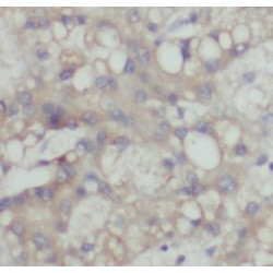 Aldehyde Dehydrogenase Family 1 Member A3 (ALDH1A3) Antibody