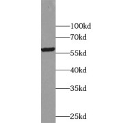 WB analysis of mouse liver tissue, using ALDH1A3 antibody (1/1000 dilution).