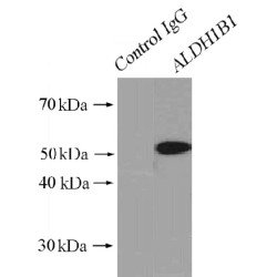 Aldehyde Dehydrogenase X, Mitochondrial (ALDH1B1) Antibody