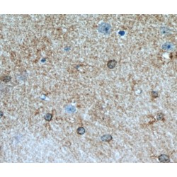 Aldehyde Dehydrogenase 1 Family Member L1 (ALDH1L1) Antibody