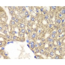 Aldehyde Dehydrogenase, Mitochondrial (ALDH2) Antibody