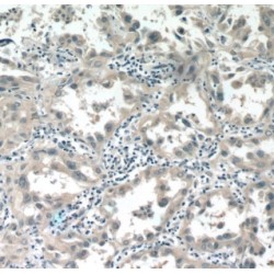 Aldehyde Dehydrogenase 3 Family Member B1 (ALDH3B1) Antibody