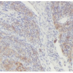 Aldehyde Dehydrogenase 7 Family Member A1 (ALDH7A1) Antibody