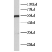 WB analysis of mouse liver tissue, using ALDH7A1 antibody (1/1000 dilution).