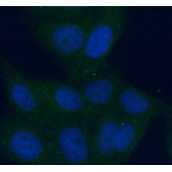 Aldehyde Dehydrogenase 8 Family Member A1 (ALDH8A1) Antibody