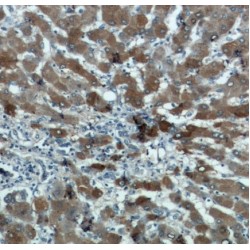 Aldehyde Dehydrogenase 8 Family Member A1 (ALDH8A1) Antibody