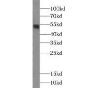 WB analysis of L02 cells, using ALDH8A1 antibody (1/500 dilution).