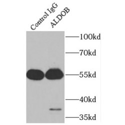 Fructose Bisphosphate Aldolase B (ALDOB) Antibody