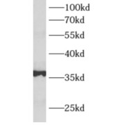 WB analysis of mouse kidney tissue, using ALDOB antibody (1/4000 dilution).