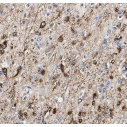 ALG1, Chitobiosyldiphosphodolichol Beta-Mannosyltransferase (ALG1) Antibody