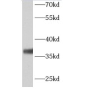 WB analysis of human kidney tissue, using ALG5 antibody (1/500 dilution).