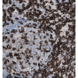 ALK,CD246 Antibody