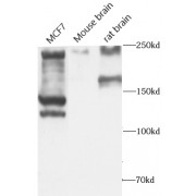 WB analysis of Various lysates, using ALK,CD246 antibody (1/600 dilution).