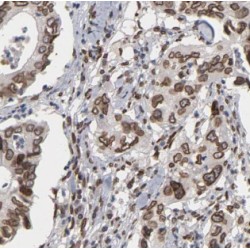 AlkB Homolog 3, Alpha-Ketoglutaratedependent Dioxygenase (ALKBH3) Antibody