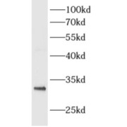 WB analysis of mouse heart tissue, using ALKBH3 antibody (1/1000 dilution).