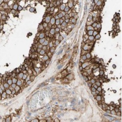 Probable Allantoicase (ALLC) Antibody