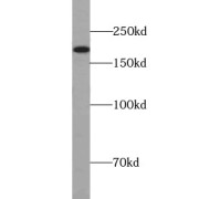 WB analysis of HepG2 cells, using A2M antibody (1/1000 dilution).