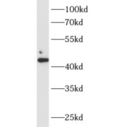 WB analysis of A549 cells, using Alpha-sarcoglycan antibody (1/1000 dilution).