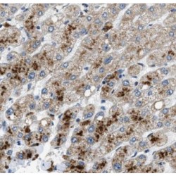 Alpha-Protein Kinase 1 (ALPK1) Antibody