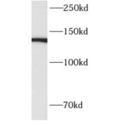 WB analysis of COLO 320 cells, using ALPK1 antibody (1/500 dilution).