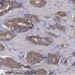 AMACR / p504S Antibody