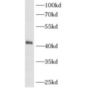 WB analysis of Recombinant AMACR protein, using AMACR antibody (1/1000 dilution).