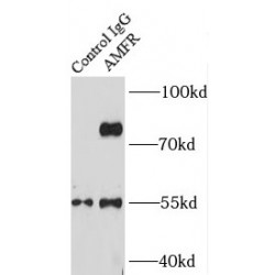 Autocrine Motility Factor Receptor (AMFR) Antibody