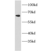 WB analysis of mouse testis tissue, using AMH antibody (1/100 dilution).