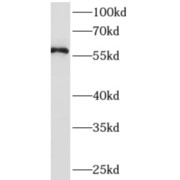 WB analysis of Y79 cells, using AMIGO2 antibody (1/500 dilution).