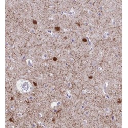 AMME Syndrome Candidate Gene 1 Protein (AMMECR1) Antibody